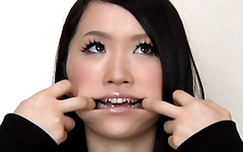 歯19