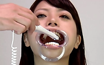 歯07